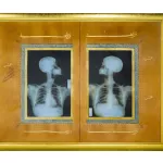 An artwork showing a double X-ray of a human skeleton agains a black and gold background.